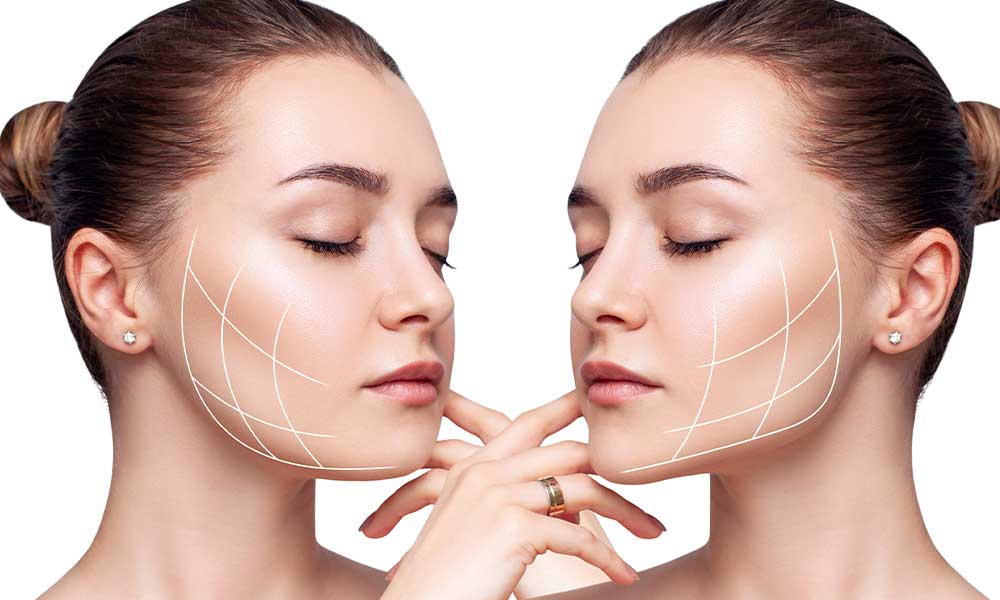 Jawline Dolgusu: Çene Hattını Belirginleştirme ve Sıkılaştırma