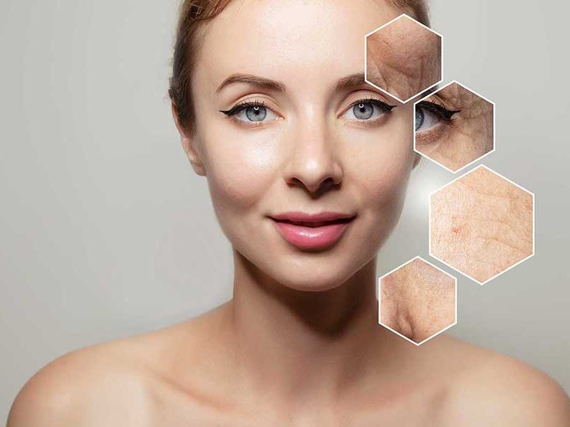 Anti-Aging Mezoterapi