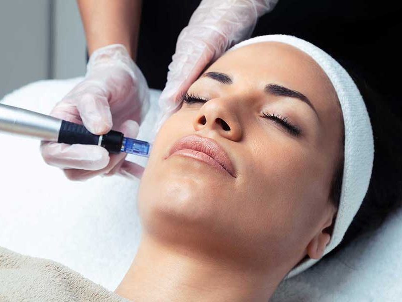Dermapen